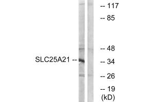 Western blot analysis of extracts from HepG2 cells, using SLC25A21 antibody. (SLC25A21 Antikörper  (Internal Region))