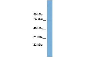 WB Suggested Anti-POLR3C  Antibody Titration: 0. (POLR3C Antikörper  (Middle Region))