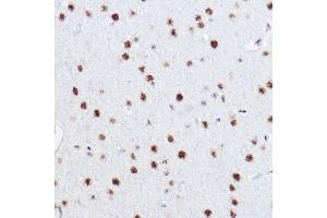 Immunohistochemistry of paraffin-embedded rat brain using p73 Rabbit mAb (ABIN1678945, ABIN1678944, ABIN7101487 and ABIN7101488) at dilution of 1:100 (40x lens). (Tumor Protein p73 Antikörper)