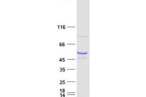 Trmt11 Protein (Myc-DYKDDDDK Tag)