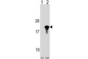 Western Blotting (WB) image for anti-Peptidylprolyl Isomerase (Cyclophilin)-Like 1 (PPIL1) antibody (ABIN2998971) (PPIL1 Antikörper)