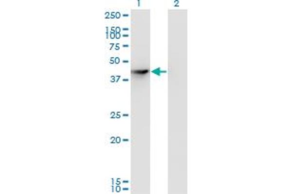 SEPHS1 Antikörper  (AA 1-96)