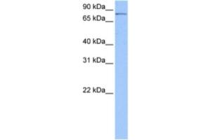 Western Blotting (WB) image for anti-Polyribonucleotide Nucleotidyltransferase 1 (PNPT1) antibody (ABIN2462319) (PNPT1 Antikörper)