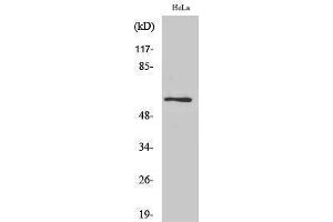 Western Blotting (WB) image for anti-Programmed Cell Death 4 (PDCD4) (Tyr674) antibody (ABIN3186356) (PDCD4 Antikörper  (Tyr674))