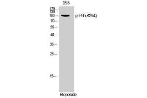 Western Blotting (WB) image for anti-PR (pSer294) antibody (ABIN3173167) (PR (pSer294) Antikörper)