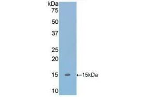 Detection of Recombinant TGFb1, Human using Polyclonal Antibody to Transforming Growth Factor Beta 1 (TGFb1) (TGFB1 Antikörper  (AA 279-390))