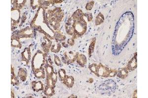 Immunohistochemistry (IHC) image for anti-Keratin 8 (KRT8) (C-Term) antibody (ABIN870549) (KRT8 Antikörper  (C-Term))