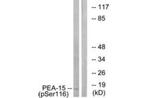 Western blot analysis of extracts from COS7 cells treated with INSULIN 0. (PEA15 Antikörper  (pSer116))