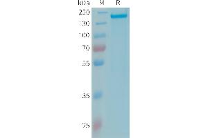 Human CFH Protein, His Tag on SDS-PAGE under reducing condition. (Complement Factor H Protein (CFH) (AA 19-1231) (His tag))