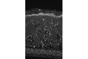 Hsp22 Immunohistochemistry. (HSPB8 Antikörper)