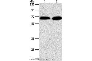 Western blot analysis of Jurkat and NIH/3T3 cell, using PRKCA Polyclonal Antibody at dilution of 1:500 (PKC alpha Antikörper)