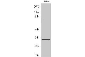 Western Blotting (WB) image for anti-Neuralized E3 Ubiquitin Protein Ligase 1B (NEURL1B) (Internal Region) antibody (ABIN6284885) (NEURL1B Antikörper  (Internal Region))