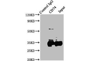 Immunoprecipitating CD74 in Raji whole cell lysate Lane 1: Rabbit control IgG instead of ABIN7155575 in Raji whole cell lysate. (CD74 Antikörper  (AA 137-296))