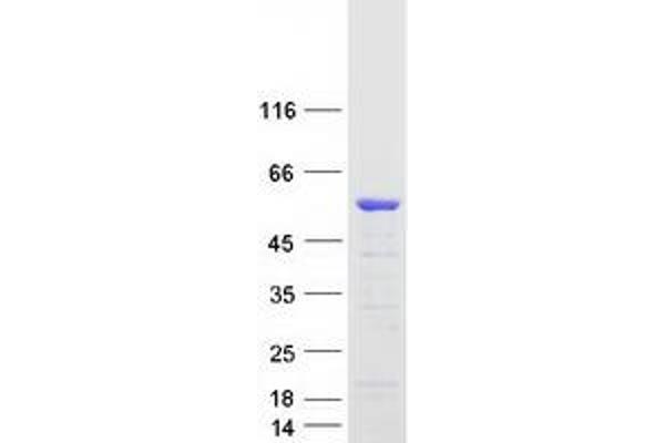 Dematin Protein (Transcript Variant 1) (Myc-DYKDDDDK Tag)