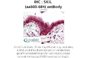 Image no. 1 for anti-SKI-Like Oncogene (SKIL) (AA 600-684) antibody (ABIN1739313) (SKIL Antikörper  (AA 600-684))