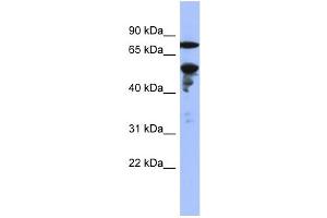 WB Suggested Anti-ZNF549 Antibody Titration:  0. (ZNF549 Antikörper  (Middle Region))