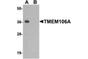 Western blot analysis of TMEM106A in A-20 cell lysate with TMEM106A Antibody  at 1 µg/ml in (A) the absence and (B) the presence of blocking peptide. (TMEM106A Antikörper  (N-Term))