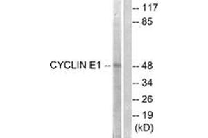 Western blot analysis of extracts from HeLa cells, treated with Paclitaxel 1uM 60', using Cyclin E1 (Ab-395) Antibody. (Cyclin E1 Antikörper  (AA 361-410))