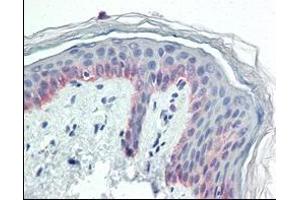 Immunohistochemical analysis of paraffin-embedded human skin tissues using CK5 antibody. (Cytokeratin 5 Antikörper)