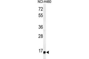 Western Blotting (WB) image for anti-Ribosomal Protein S13 (RPS13) antibody (ABIN3002137) (RPS13 Antikörper)