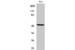 Western Blotting (WB) image for anti-Activating Transcription Factor 2 (ATF2) (Ser220), (Ser259) antibody (ABIN3179881) (ATF2 Antikörper  (Ser220, Ser259))