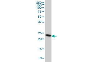 TRAPPC4 monoclonal antibody (M01), clone 2D10 Western Blot analysis of TRAPPC4 expression in HeLa . (TRAPPC4 Antikörper  (AA 1-219))