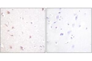 Immunohistochemistry analysis of paraffin-embedded human brain tissue, using NIFK (Ab-234) Antibody. (NIFK Antikörper  (AA 200-249))