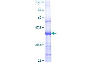 Image no. 1 for Receptor tyrosine-protein kinase erbB-2 (ErbB2/Her2) (AA 22-121) protein (GST tag) (ABIN1353013) (ErbB2/Her2 Protein (AA 22-121) (GST tag))