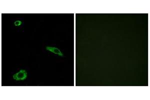 Immunofluorescence analysis of MCF-7 cells, using ACTHR antibody. (MC2R Antikörper  (C-Term))