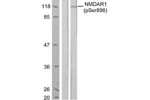 Western blot analysis of extract from MCF7 cells, untreated or treated with estradiol (100nM, 20min), using NMDAR1 (phospho-Ser896) antibody (E011104). (GRIN1/NMDAR1 Antikörper  (pSer896))
