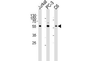 Western blot analysis of lysates from Jurkat, PC-3, C6 cell line (from left to right), using AKT1/2/3 Antibody (Center) (ABIN6244286 and ABIN6577440). (AKT 1/2/3 Antikörper  (AA 278-312))