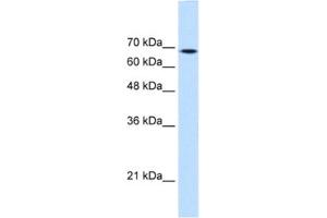 Western Blotting (WB) image for anti-Transglutaminase 2 (C Polypeptide, Protein-Glutamine-gamma-Glutamyltransferase) (TGM2) antibody (ABIN2463067) (Transglutaminase 2 Antikörper)