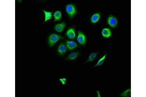 Immunofluorescence staining of A549 cells with ABIN7161627 at 1:166, counter-stained with DAPI. (NOS2 Antikörper  (AA 17-141))