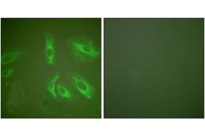 Immunofluorescence analysis of HeLa cells, using Gastrin Antibody. (Gastrin Antikörper  (AA 52-101))