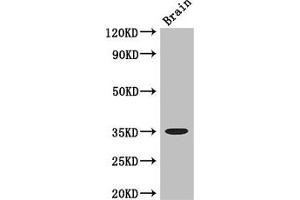 Western Blot Positive WB detected in: Mouse brain tissue All lanes: MYOD1 antibody at 3 μg/mL Secondary Goat polyclonal to rabbit IgG at 1/50000 dilution Predicted band size: 35 kDa Observed band size: 35 kDa (MYOD1 Antikörper  (AA 116-320))