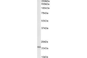 Biotinylated ABIN4902634 (1µg/ml) staining of Rat Brain lysate (35µg protein in RIPA buffer), exactly mirroring its parental non-biotinylated product. (FTL Antikörper  (C-Term) (Biotin))