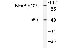 Image no. 2 for anti-Nuclear Factor of kappa Light Polypeptide Gene Enhancer in B-Cells 1 (NFKB1) antibody (ABIN271744) (NFKB1 Antikörper)
