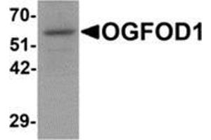 Western blot analysis of OGFOD1 in Daudi cell lysate with OGFOD1 antibody at 1 μg/ml. (OGFOD1 Antikörper  (C-Term))