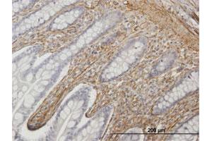 Immunoperoxidase of purified MaxPab antibody to CALD1 on formalin-fixed paraffin-embedded human small Intestine. (Caldesmon Antikörper  (AA 1-538))