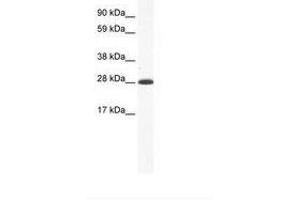 Image no. 1 for anti-Distal-Less Homeobox 4 (DLX4) (AA 57-106) antibody (ABIN202108) (DLX4 Antikörper  (AA 57-106))