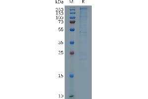 Human L Protein, His Tag on SDS-PAGE under reducing condition. (LAMa4 Protein (AA 25-1823) (His tag))