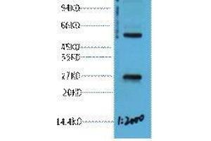 Western Blot (WB) analysis of 293T cell lysate, diluted at 1:2000. (EFHD1 Antikörper)