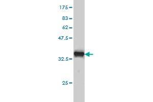 Western Blotting (WB) image for anti-Proteasome (Prosome, Macropain) Subunit, beta Type, 8 (Large Multifunctional Peptidase 7) (PSMB8) (AA 173-272) antibody (ABIN562483)