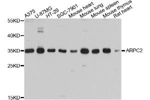 Western blot analysis of extracts of various cell lines, using ARPC2 antibody. (ARPC2 Antikörper)