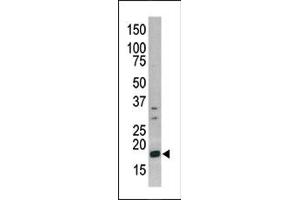 Image no. 1 for anti-Histone 3 (H3) (pSer10) antibody (ABIN358062) (Histone 3 Antikörper  (pSer10))