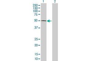 Lane 1: ACP6 transfected lysate ( 48. (ACP6 293T Cell Transient Overexpression Lysate(Denatured))