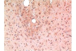 Immunohistochemical analysis of paraffin-embedded Rat Brain Tissue using TGFβ1 Mouse mAb diluted at 1:200. (TGFB1 Antikörper)