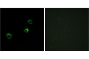 Image no. 2 for anti-Cytochrome B-561 Domain Containing 1 (CYB561D1) (AA 180-229) antibody (ABIN2889869) (CYB561D1 Antikörper  (AA 180-229))