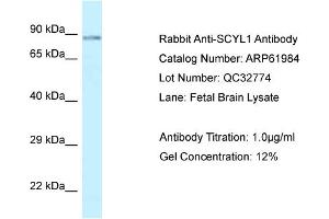 Western Blotting (WB) image for anti-SCY1-Like 1 (SCYL1) (C-Term) antibody (ABIN786532) (SCYL1 Antikörper  (C-Term))