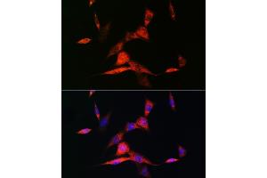 Immunofluorescence analysis of NIH-3T3 cells using RARβ Rabbit mAb (ABIN7269947) at dilution of 1:100 (40x lens). (Retinoic Acid Receptor beta Antikörper)